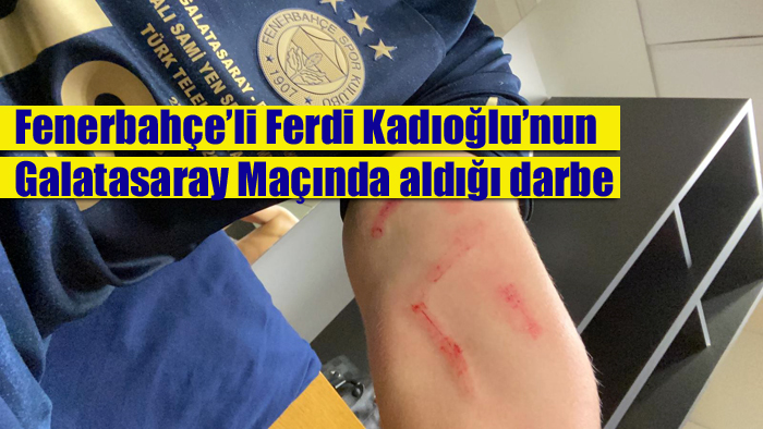 Fenerbahçe’li Ferdi Kadıoğlu’nun Galatasaray Maçında aldığı darbe
